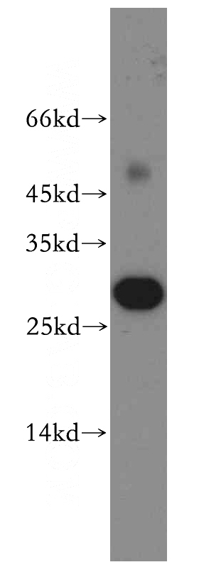 mouse skin tissue were subjected to SDS PAGE followed by western blot with Catalog No:108269(ASPRV1 antibody) at dilution of 1:300