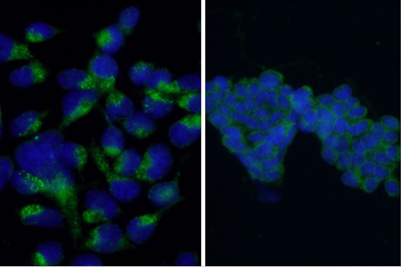 Immunofluorescent analysis of Starvation treated HEK-293 cells using Catalog No:112164 (LC3 Antibody) at dilution of 1:50 and Alexa Fluor 488-congugated AffiniPure Goat Anti-Rabbit IgG(H+L). 20 mM chloroquine was used to block the autophagy flux.