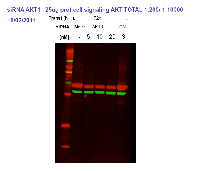 Control:siRNA AKT1 result with Pan-AKT antibody.From Dr.Eva Martinez-Balibrea.