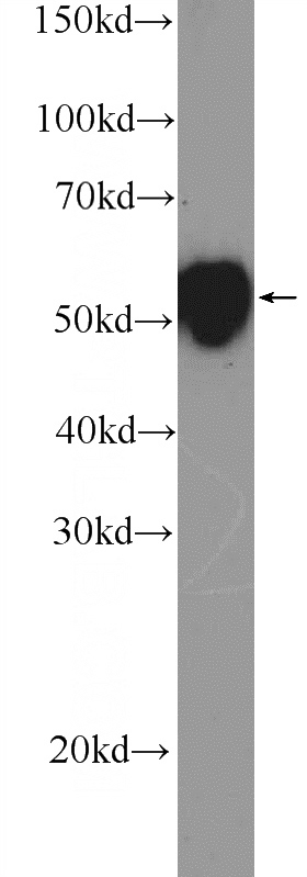 A431 cells were subjected to SDS PAGE followed by western blot with Catalog No:109811(CK7-Specific Antibody) at dilution of 1:1000