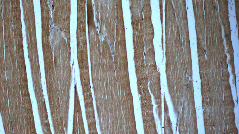 Immunohistochemistry of paraffin-embedded human skeletal muscle slide using Catalog No:110738(FNDC5 Antibody) at dilution of 1:50