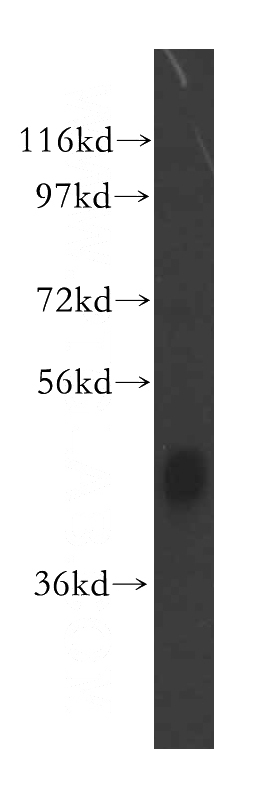 mouse liver tissue were subjected to SDS PAGE followed by western blot with Catalog No:111888(JMJD6 antibody) at dilution of 1:500