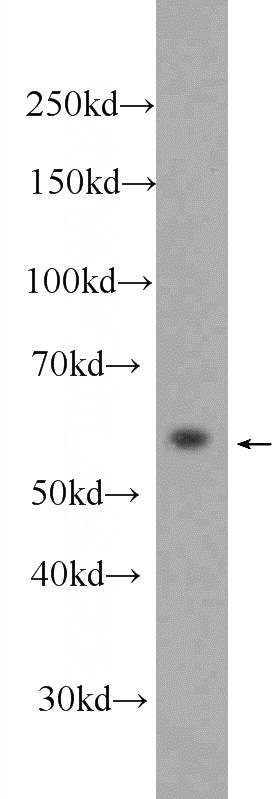SMMC-7721 cells were subjected to SDS PAGE followed by western blot with Catalog No:112745(MPND Antibody) at dilution of 1:1000