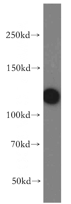 HeLa cells were subjected to SDS PAGE followed by western blot with Catalog No:109504(CP110 antibody) at dilution of 1:400