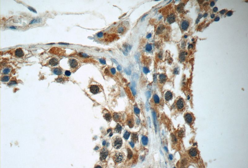 Immunohistochemistry of paraffin-embedded human testis tissue slide using Catalog No:110610(FDXACB1 Antibody) at dilution of 1:50 (under 40x lens)
