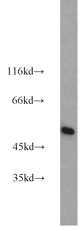 HeLa cells were subjected to SDS PAGE followed by western blot with Catalog No:111042(GLUD1 antibody) at dilution of 1:3000
