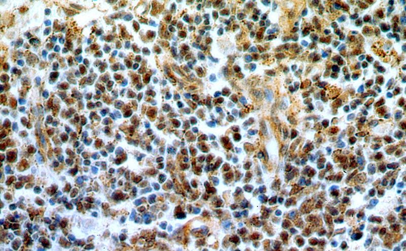 Immunohistochemical of paraffin-embedded human spleen using Catalog No:111835(IRF3 antibody) at dilution of 1:50 (under 40x lens)