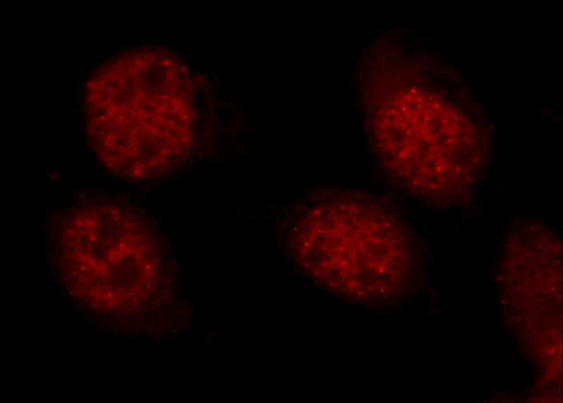 Immunofluorescent analysis of A431 cells using Catalog No:111556(HSF1 Antibody) at dilution of 1:50 and Rhodamine-Goat anti-Rabbit IgG