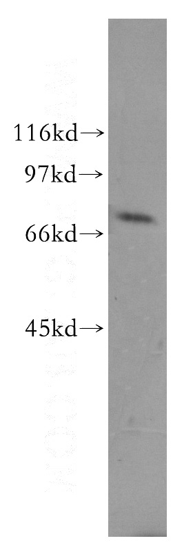 human small intestine tissue were subjected to SDS PAGE followed by western blot with Catalog No:111254(USH1C antibody) at dilution of 1:500