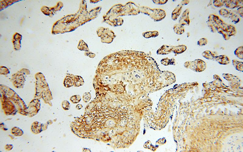 Immunohistochemical of paraffin-embedded human placenta using Catalog No:112526(MFAP5 antibody) at dilution of 1:100 (under 10x lens)