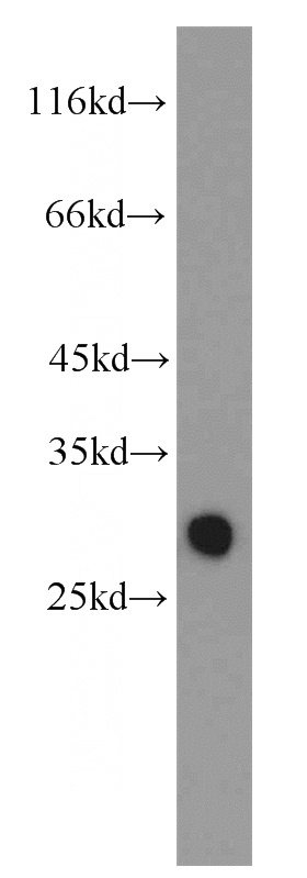 human testis tissue were subjected to SDS PAGE followed by western blot with Catalog No:111186(GSTM3 antibody) at dilution of 1:1200