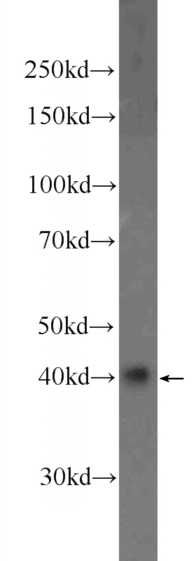 A549 cells were subjected to SDS PAGE followed by western blot with Catalog No:111439(HOXD13 Antibody) at dilution of 1:300