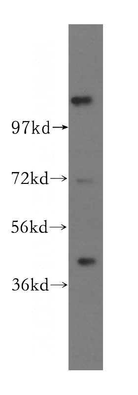 human brain tissue were subjected to SDS PAGE followed by western blot with Catalog No:116065(TIPIN antibody) at dilution of 1:500