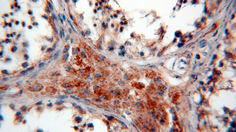 Immunohistochemical of paraffin-embedded human testis using Catalog No:115936(TEKT1 antibody) at dilution of 1:100 (under 40x lens)