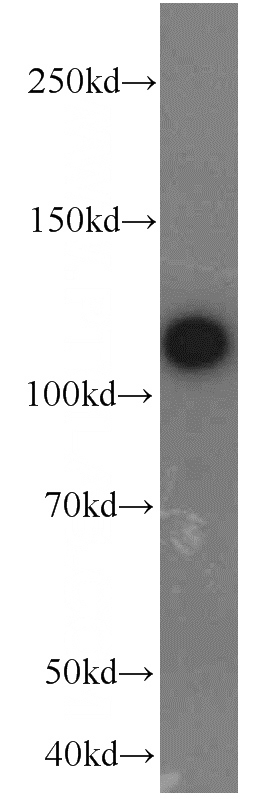 MCF7 cells were subjected to SDS PAGE followed by western blot with Catalog No:110455(FAK antibody) at dilution of 1:2000