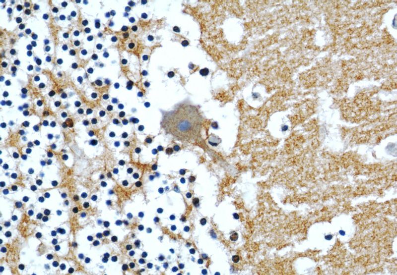 Immunohistochemical of paraffin-embedded human cerebellum using Catalog No:108882(CASPR antibody) at dilution of 1:50 (under 40x lens)