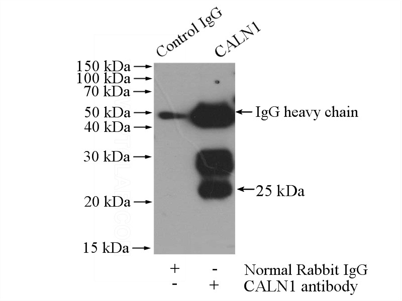 IP Result of anti-CALN1 (IP:Catalog No:108831, 4ug; Detection:Catalog No:108831 1:300) with rat brain tissue lysate 4000ug.