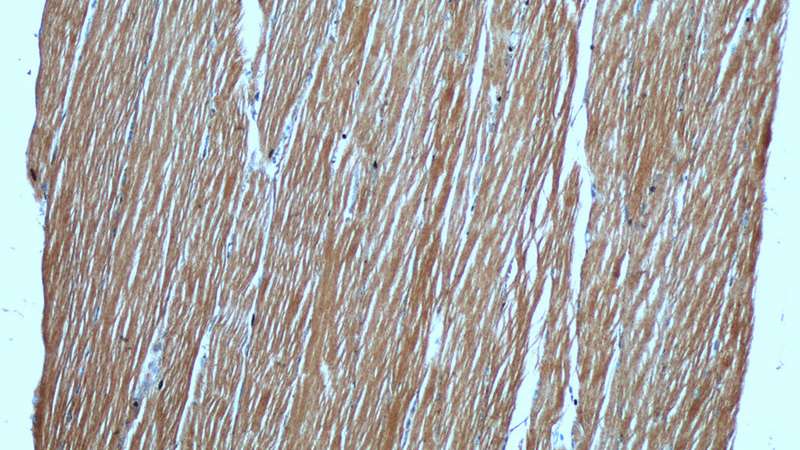 Immunohistochemistry of paraffin-embedded human skeletal muscle tissue slide using Catalog No:112934(MYH4-Specific Antibody) at dilution of 1:50 (under 10x lens)