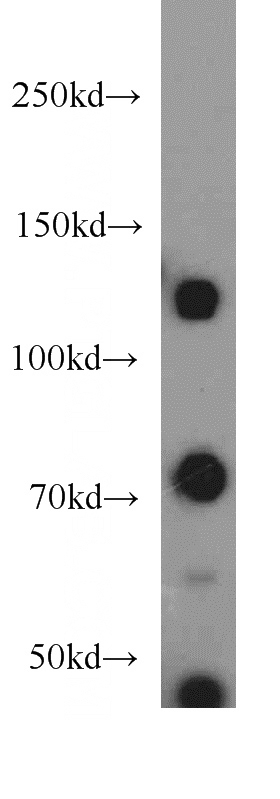 HeLa cells were subjected to SDS PAGE followed by western blot with Catalog No:109871(DAXX antibody) at dilution of 1:1000