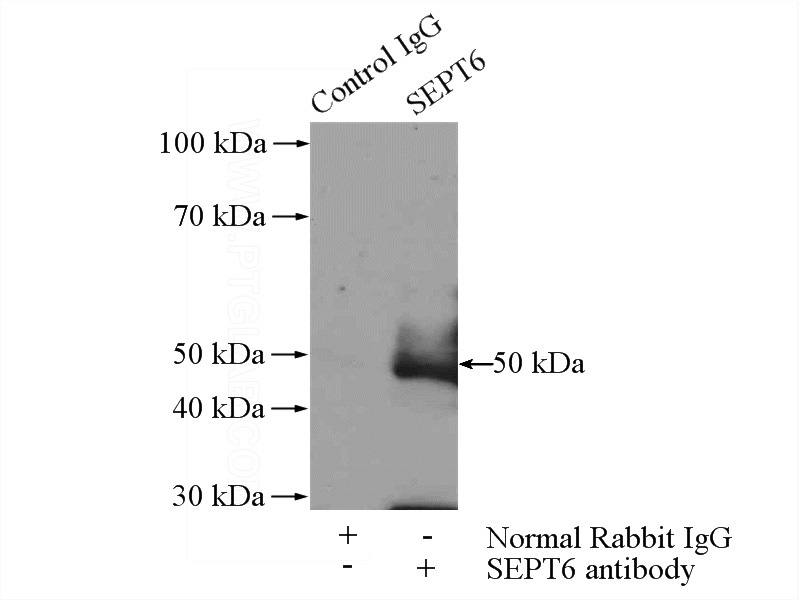 IP Result of anti-SEPT6 (IP:Catalog No:115120, 4ug; Detection:Catalog No:115120 1:600) with rat brain tissue lysate 4000ug.