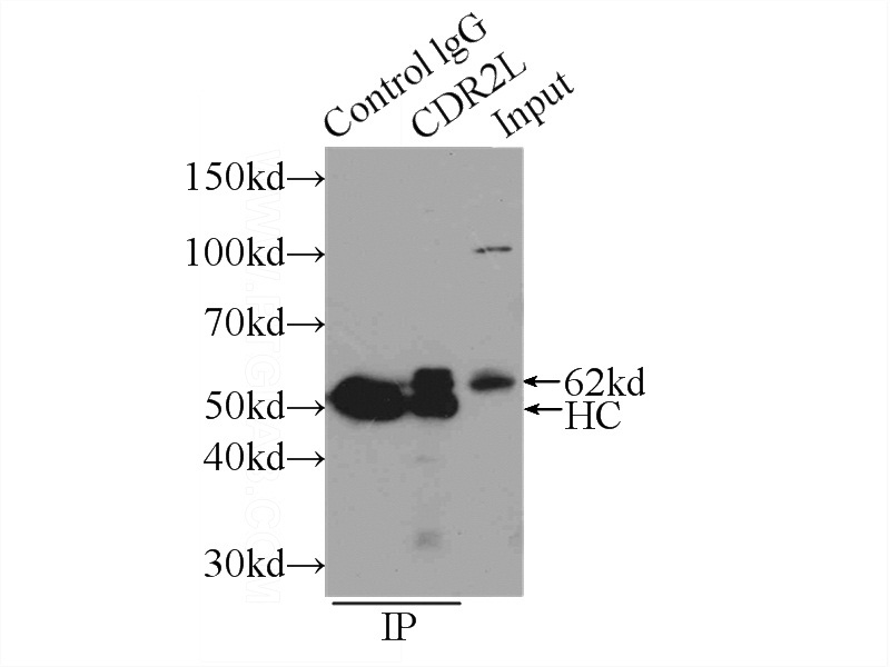 IP Result of anti-CDR2L (IP:Catalog No:109173, 3ug; Detection:Catalog No:109173 1:500) with SH-SY5Y cells lysate 2500ug.