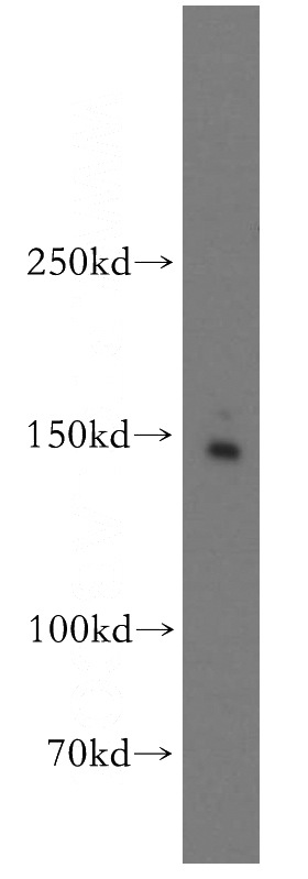HEK-293 cells were subjected to SDS PAGE followed by western blot with Catalog No:110023(Drosha antibody) at dilution of 1:800