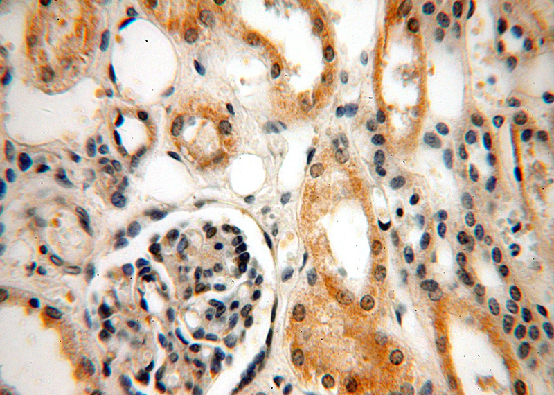 Immunohistochemical of paraffin-embedded human kidney using Catalog No:111789(INF2 antibody) at dilution of 1:100 (under 40x lens)