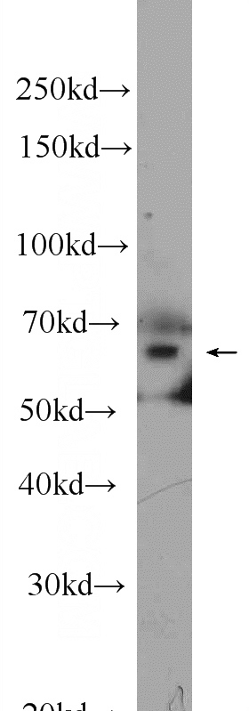 Raji cells were subjected to SDS PAGE followed by western blot with Catalog No:114684(RELB Antibody) at dilution of 1:1000