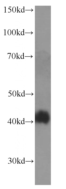 MCF-7 cells were subjected to SDS PAGE followed by western blot with Catalog No:107337(NR2F6 Antibody) at dilution of 1:1000