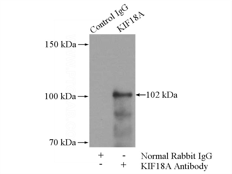 IP Result of anti-KIF18A (IP:Catalog No:112002, 4ug; Detection:Catalog No:112002 1:500) with Jurkat cells lysate 2400ug.