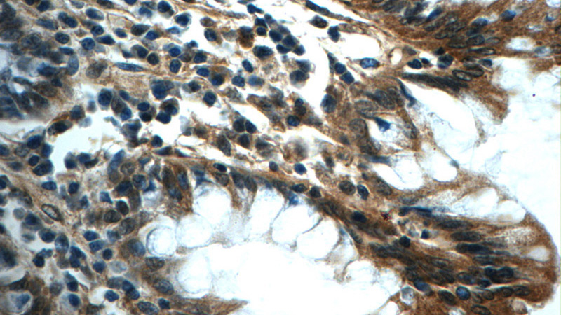 Immunohistochemistry of paraffin-embedded human colon tissue slide using Catalog No:115125(SERAC1 Antibody) at dilution of 1:50 (under 40x lens)