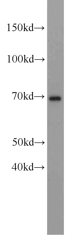 L02 cells were subjected to SDS PAGE followed by western blot with Catalog No:111542(HSD11B1 antibody) at dilution of 1:400