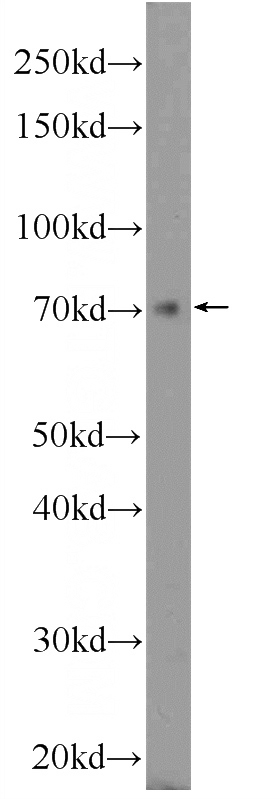 HepG2 cells were subjected to SDS PAGE followed by western blot with Catalog No:117179(ZNF460 Antibody) at dilution of 1:600