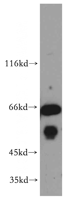 mouse lung tissue were subjected to SDS PAGE followed by western blot with Catalog No:110498(EXD2 antibody) at dilution of 1:300