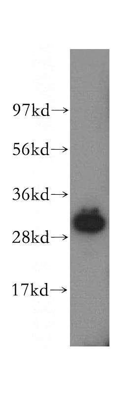 human kidney tissue were subjected to SDS PAGE followed by western blot with Catalog No:111761(IMPA1 antibody) at dilution of 1:300