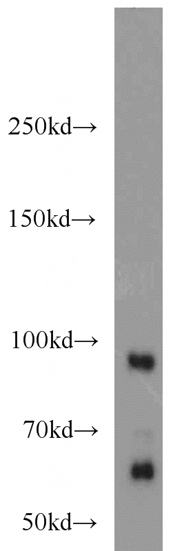 mouse brain tissue were subjected to SDS PAGE followed by western blot with Catalog No:114190(PRICKLE1 antibody) at dilution of 1:1000