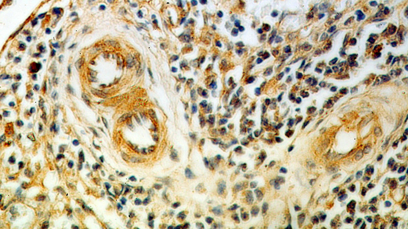 Immunohistochemical of paraffin-embedded human spleen using Catalog No:107828(AGGF1 antibody) at dilution of 1:25 (under 40x lens)