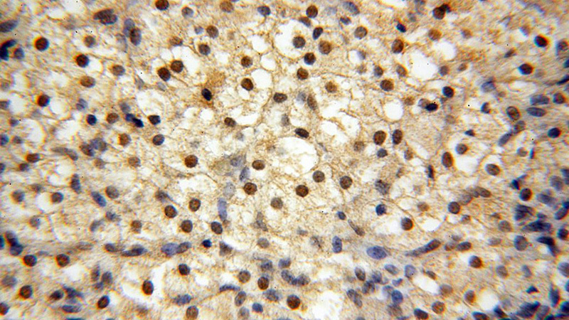 Immunohistochemical of paraffin-embedded human ovary using Catalog No:114590(RBBP4 antibody) at dilution of 1:50 (under 40x lens)