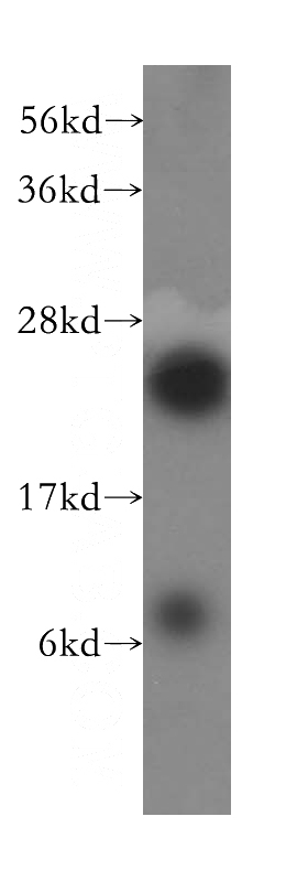 HepG2 cells were subjected to SDS PAGE followed by western blot with Catalog No:114810(RPL10A antibody) at dilution of 1:1000