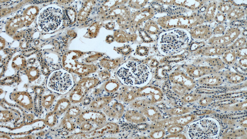 Immunohistochemical of paraffin-embedded human kidney using Catalog No:107158(CISD2-Specific antibody) at dilution of 1:50 (under 10x lens)