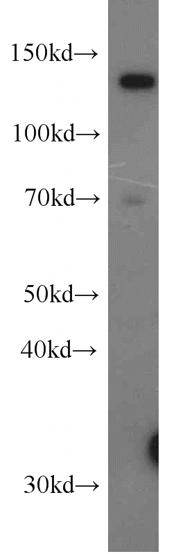 HeLa cells were subjected to SDS PAGE followed by western blot with Catalog No:116603(USP28 antibody) at dilution of 1:1000