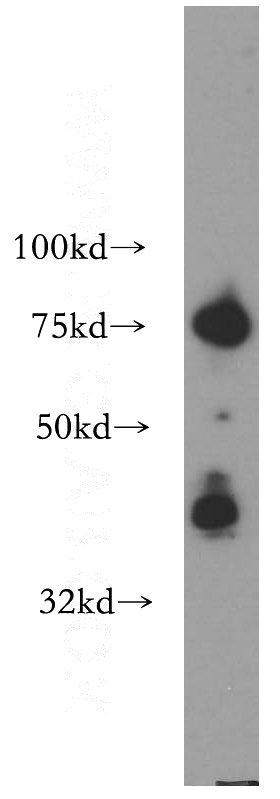 BxPC-3 cells were subjected to SDS PAGE followed by western blot with Catalog No:108744(CA12 antibody) at dilution of 1:300
