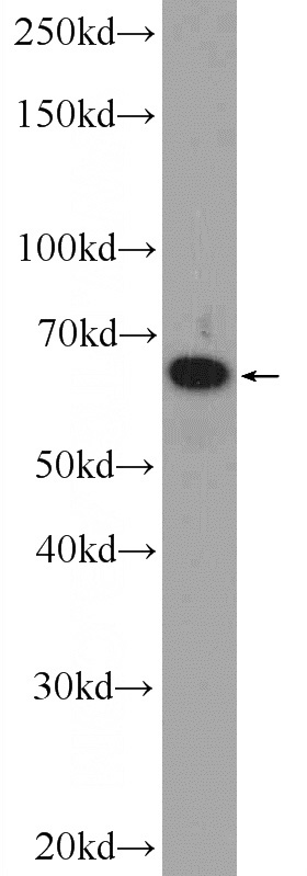 A549 cells were subjected to SDS PAGE followed by western blot with Catalog No:114616(RBM47 Antibody) at dilution of 1:1000