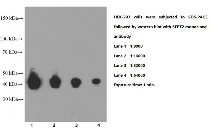 HEK-293 cells were subjected to SDS PAGE followed by western blot with Catalog No:107524 (SEPT2 Antibody) at various dilutions.