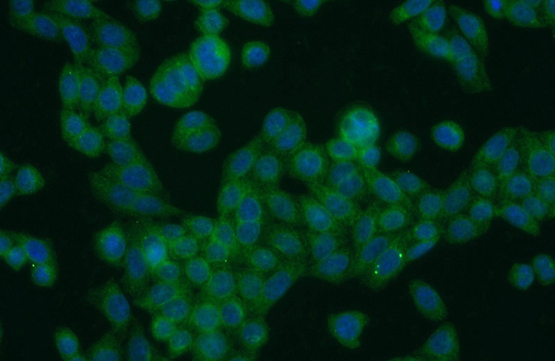 Immunofluorescent analysis of HeLa cells using Catalog No:116552(UFSP2 Antibody) at dilution of 1:25 and Alexa Fluor 488-congugated AffiniPure Goat Anti-Rabbit IgG(H+L)