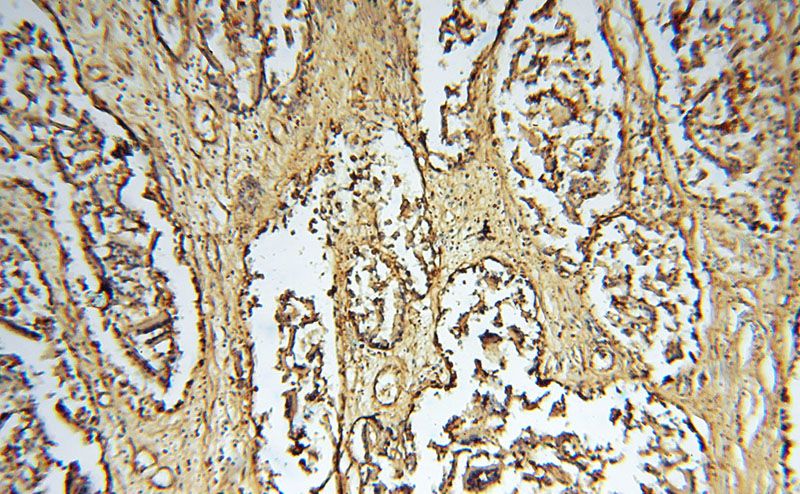 Immunohistochemical of paraffin-embedded human prostate using Catalog No:112184(LDHB antibody) at dilution of 1:100 (under 10x lens)