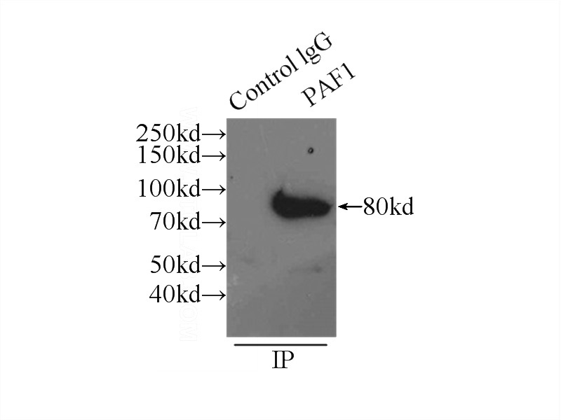 IP Result of anti-PAF1 (IP:Catalog No:113484, 3ug; Detection:Catalog No:113484 1:1000) with HeLa cells lysate 3000ug.