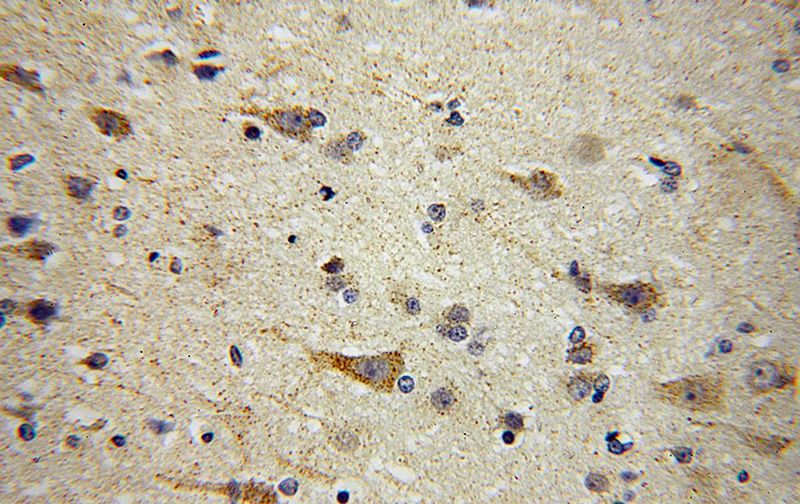 Immunohistochemical of paraffin-embedded human brain using Catalog No:117071(AUH antibody) at dilution of 1:100 (under 40x lens)
