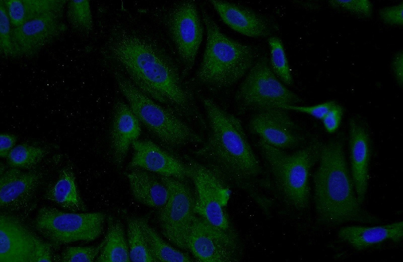 Immunofluorescent analysis of A549 cells using Catalog No:109755(DCP1B Antibody) at dilution of 1:50 and Alexa Fluor 488-congugated AffiniPure Goat Anti-Rabbit IgG(H+L)