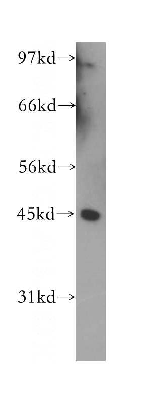 K-562 cells were subjected to SDS PAGE followed by western blot with Catalog No:116328(TRAM1 antibody) at dilution of 1:300